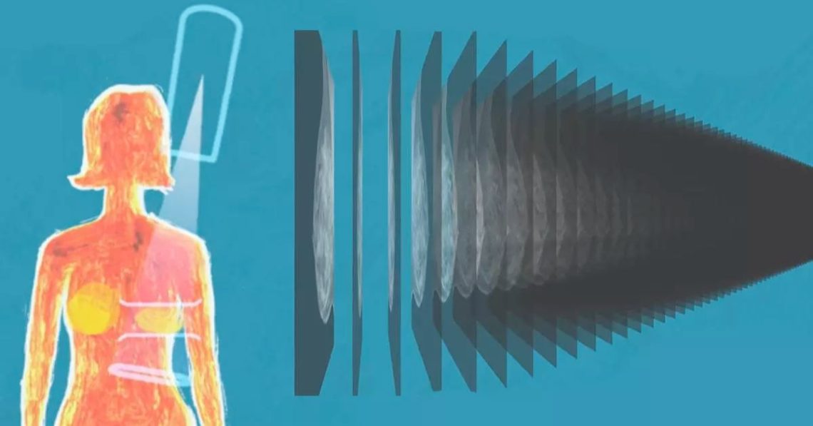 Advanced Genius 3D Mammography in Rock Sound, Eleuthera