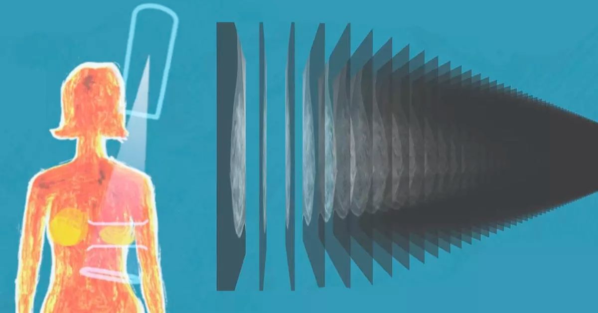 Advanced Genius 3D Mammography in Rock Sound, Eleuthera