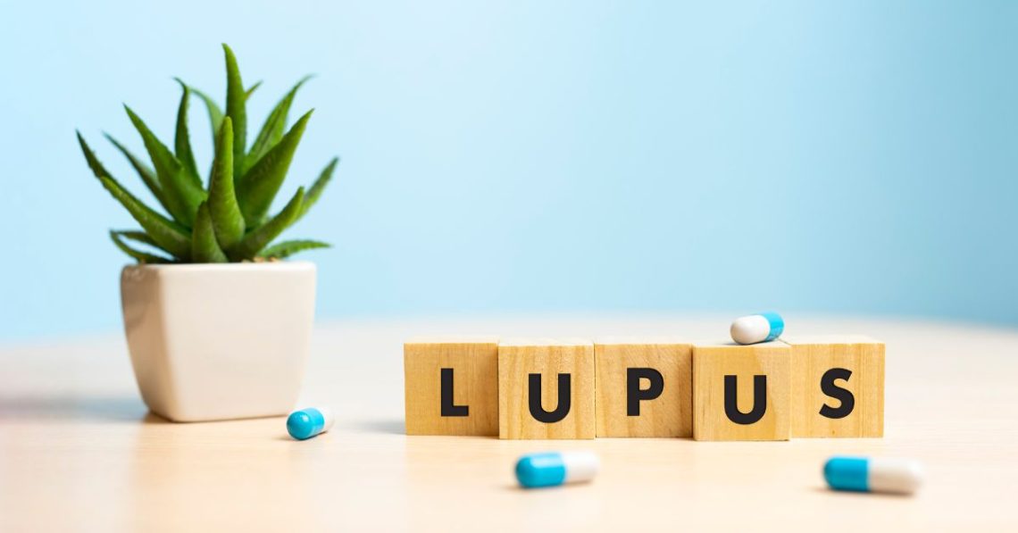 Understanding Lupus: Symptoms, Diagnosis, and Treatment