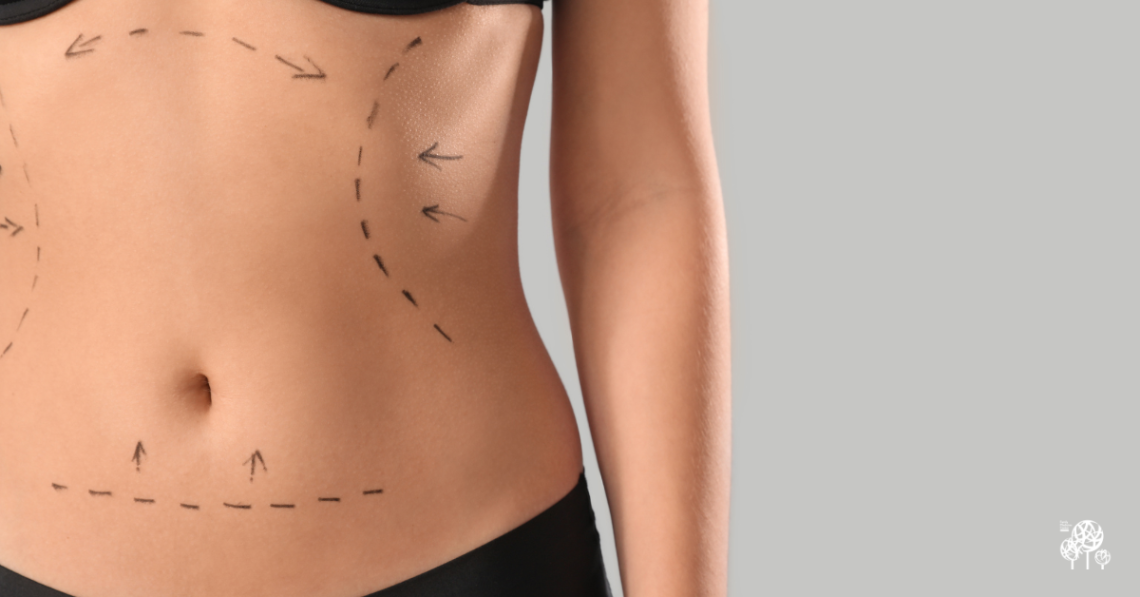Is Cosmetic Surgery Right for Me?