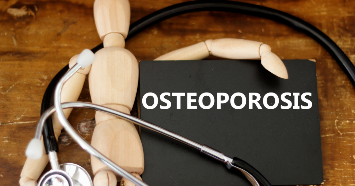 Are You At Risk For Osteoporosis?