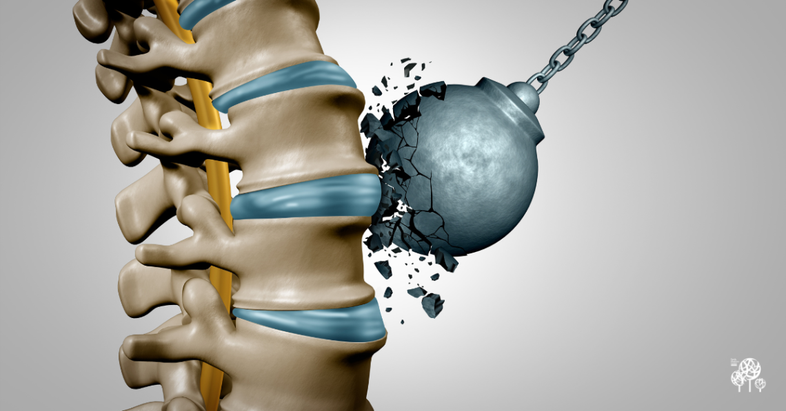 Strong Bones Start with Small Changes