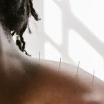 How Acupuncture Works: Ancient Wisdom, Modern Results