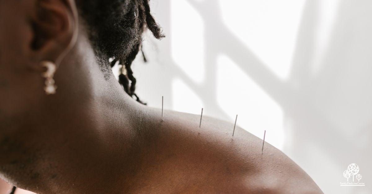 How Acupuncture Works: Ancient Wisdom, Modern Results