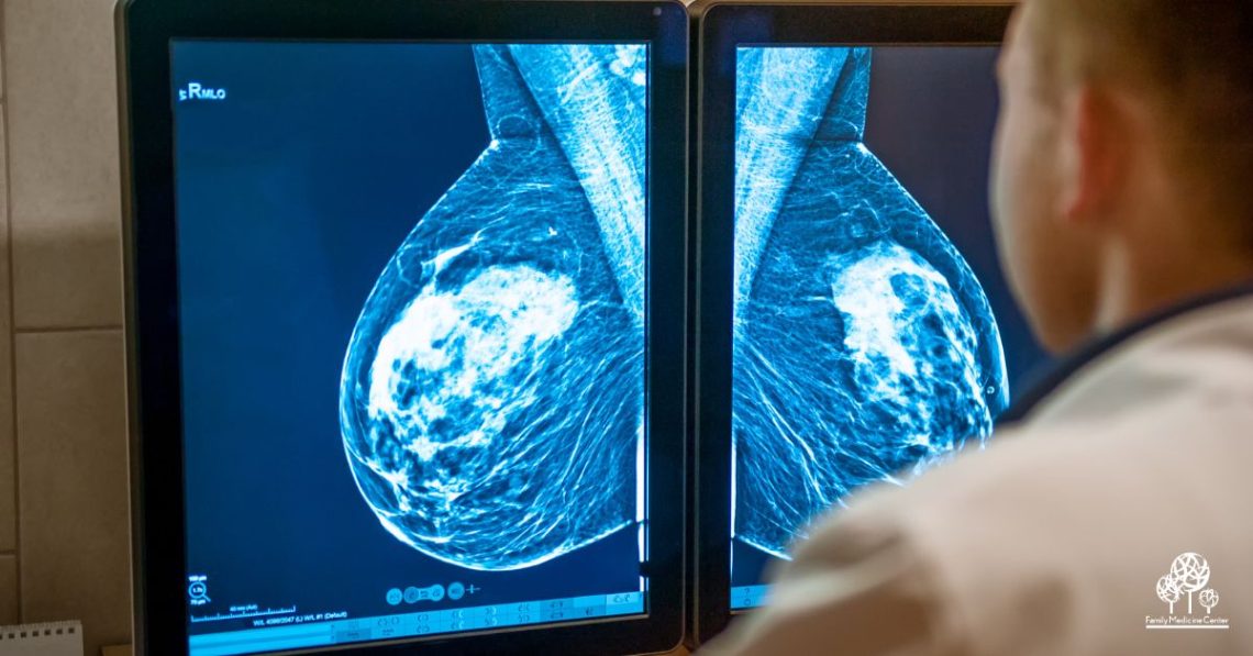 What Is a 3D Mammogram? And Is It Better?