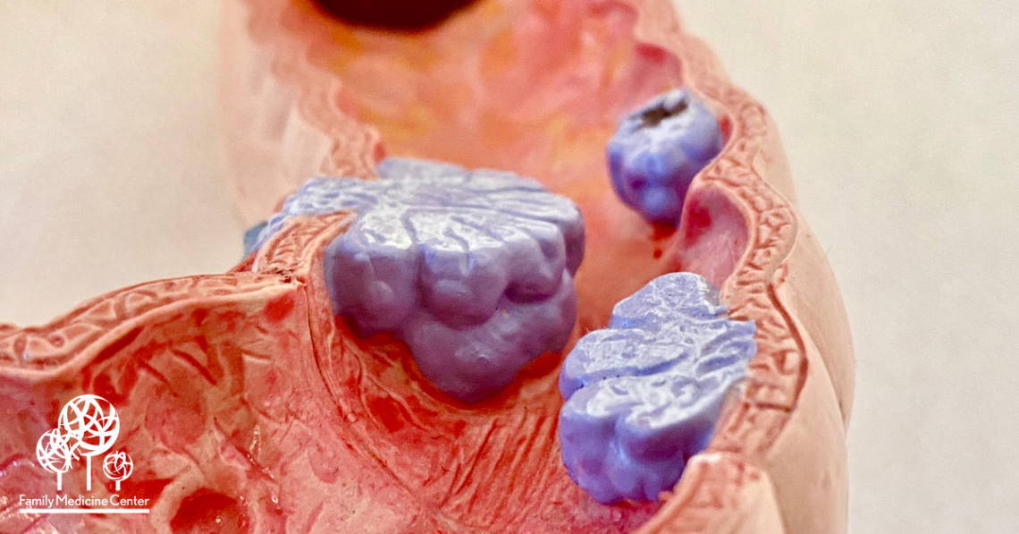 The Test That Could Save Your Life — and Takes Less Than a Day